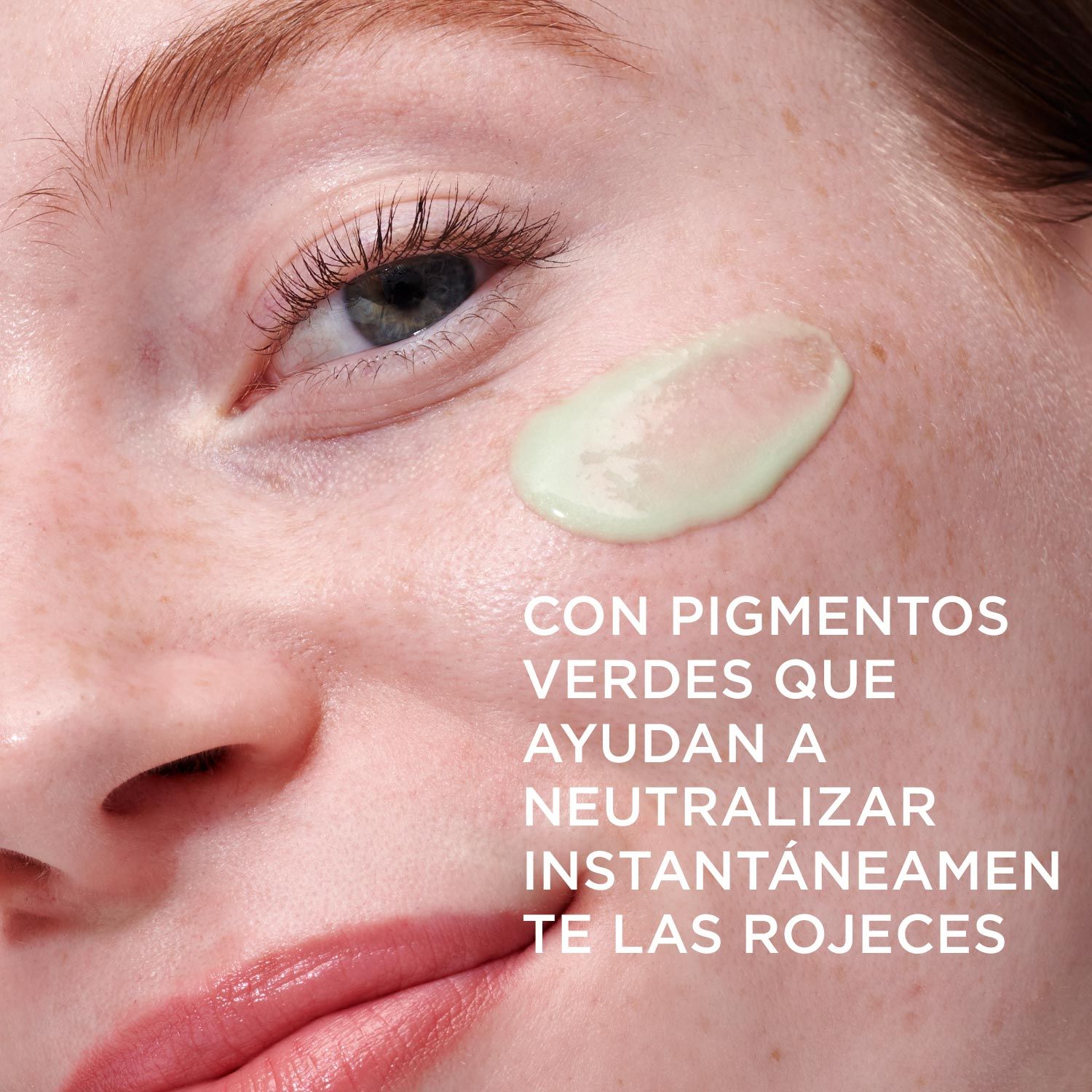 BYE BYE REDNESS (SUERO ANTI-ENROJECIMIENTO)